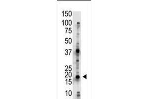 Antibody is used in Western blot to detect UBE2G2 in Jurkat cell lysate. (UBE2G2 antibody  (N-Term))