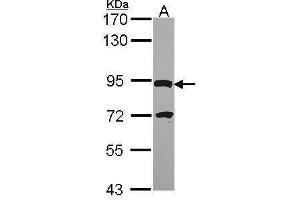 WB Image Sample (30 ug of whole cell lysate) A: Hep G2 , 7. (DPY19L4 antibody  (C-Term))