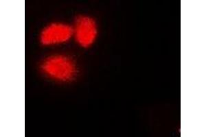Immunofluorescent analysis of Exportin 5 staining in A549 cells. (XPO5 antibody)