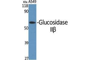 Western Blot (WB) analysis of specific cells using Glucosidase IIbeta Polyclonal Antibody. (GBA2 antibody  (Internal Region))