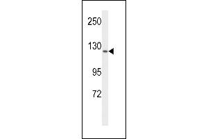 Western blot analysis of VGFR1 Antibody (ABIN653260 and ABIN2842780) in MCF-7 cell line lysates (35 μg/lane). (FLT1 antibody)