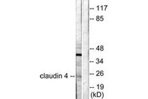 Western Blotting (WB) image for anti-Claudin 4 (CLDN4) (AA 160-209) antibody (ABIN2879120) (Claudin 4 antibody  (AA 160-209))