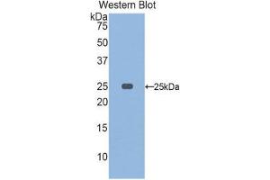 Western Blotting (WB) image for anti-Osteoclast Stimulating Factor 1 (OSTF1) (AA 10-215) antibody (ABIN1860107)