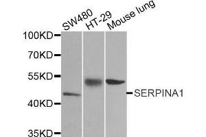 Western blot analysis of extracts of various cell lines, using SERPINA1 antibody. (SERPINA1 antibody  (AA 25-315))