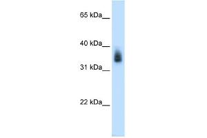 WB Suggested Anti-MAGEA8 Antibody Titration:  0.