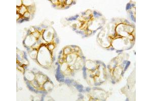 Anti-P cadherin antibody, IHC(P) IHC(P): Human Placenta Tissue (P-Cadherin antibody  (Middle Region))