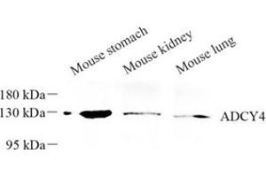 Western blot analysis of ADCY4 (ABIN7072959) at dilution of 1: 250 (ADCY4 antibody)