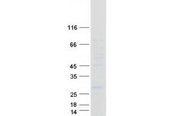 LAPTM4A Protein (Myc-DYKDDDDK Tag)
