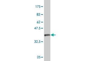 Western Blot detection against Immunogen (36. (Myosin VIIA antibody  (AA 2118-2213))