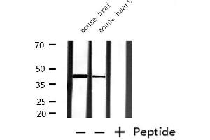 Western blot analysis of extracts from mouse brain and mouse heart, using Glutamine Synthetase Antibody.