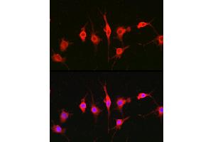 Immunofluorescence analysis of BALB-3T3 cells using Heparanase 1 Rabbit pAb (ABIN6128033, ABIN6141977, ABIN6141978 and ABIN6221391) at dilution of 1:100 (40x lens). (HPSE antibody  (AA 36-275))