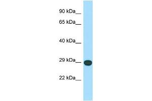 WB Suggested Anti-LRRC10 Antibody Titration: 1.