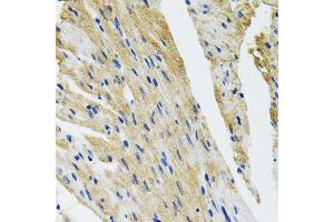 Immunohistochemistry of paraffin-embedded mouse heart using COPB2 antibody. (COPB2 antibody  (AA 657-906))