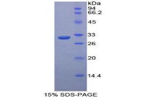 SDS-PAGE (SDS) image for Mitogen-Activated Protein Kinase Kinase Kinase 5 (MAP3K5) (AA 693-933) protein (His tag) (ABIN1879239) (ASK1 Protein (AA 693-933) (His tag))