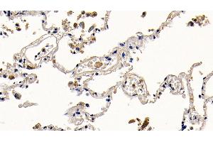 Detection of PGLYRP1 in Human Lung Tissue using Polyclonal Antibody to Peptidoglycan Recognition Protein 1 (PGLYRP1) (PGLYRP1 antibody  (AA 22-196))