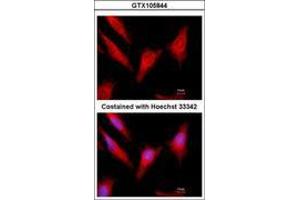Image no. 3 for anti-Vitamin K-dependent protein C (PROC) (AA 1-236) antibody (ABIN1500426) (PROC antibody  (AA 1-236))
