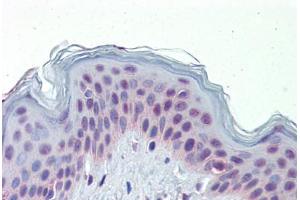 Human Skin (formalin-fixed, paraffin-embedded) stained with NR2C1 antibody ABIN462209 followed by biotinylated goat anti-rabbit IgG secondary antibody ABIN481713, alkaline phosphatase-streptavidin and chromogen. (NR2C1 antibody  (N-Term))