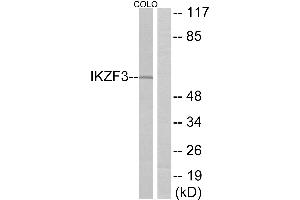 Western blot analysis of extracts from COLO cells, using IKZF3 antibody. (IKZF3 antibody)