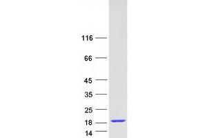Western Blotting (WB) image for NHP2 Non-Histone Chromosome Protein 2-Like 1 (NHP2L1) (Transcript Variant 1) protein (Myc-DYKDDDDK Tag) (ABIN2727262)