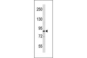 RK Antibody  (ABIN652301 and ABIN2841363) western blot analysis in T47D cell line lysates (35 μg/lane).