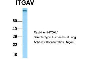 Host: Rabbit  Target Name: ITGAV  Sample Tissue: Human Fetal Lung  Antibody Dilution: 1. (CD51 antibody  (C-Term))