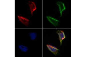 ABIN6264958 and ABIN6273159 staining Hela by IF/ICC. (SEC24A antibody  (Internal Region))