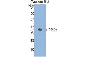 Western Blotting (WB) image for anti-Glucosidase, Alpha, Acid (GAA) (AA 755-953) antibody (ABIN1858938)