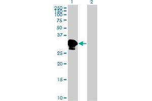 Western Blot analysis of ZNF396 expression in transfected 293T cell line by ZNF396 monoclonal antibody (M01), clone 2F8.