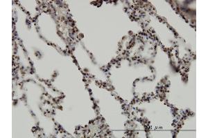 Immunoperoxidase of monoclonal antibody to RBM5 on formalin-fixed paraffin-embedded human lung. (RBM5 antibody  (AA 75-184))