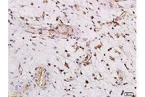 PARG1 antibody  (AA 301-400)