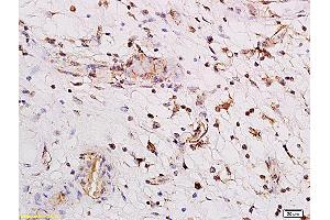 Formalin-fixed and paraffin embedded human enterocolitis labeled with Anti PARG1/Rho GTPase activating protein 29 Polyclonal Antibody, Unconjugated (ABIN762401) followed by conjugation to the secondary antibody and DAB staining