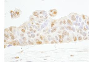 Immunohistochemistry (IHC) image for anti-Cyclin E1 (CCNE1) (AA 360-410) antibody (ABIN7453685)