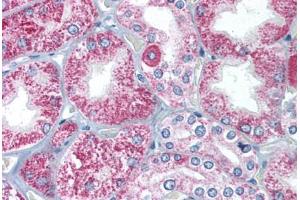 Human Kidney (formalin-fixed, paraffin-embedded) stained with TIRAP antibody ABIN213995 at 2 ug/ml followed by biotinylated goat anti-rabbit IgG secondary antibody ABIN481713, alkaline phosphatase-streptavidin and chromogen. (TIRAP antibody  (C-Term))