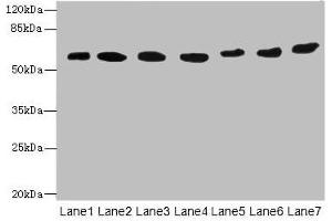 Western blot All lanes: ATL2 antibody at 1 μg/mL Lane 1: HepG2 whole cell lysate Lane 2: MCF-7 whole cell lysate Lane 3: HL60 whole cell lysate Lane 4: K562 whole cell lysate Lane 5: U251 whole cell lysate Lane 6: A549 whole cell lysate Lane 7: A431 whole cell lysate Secondary Goat polyclonal to rabbit IgG at 1/10000 dilution Predicted band size: 67, 47, 66, 65 kDa Observed band size: 67 kDa (ATL2 antibody  (AA 1-300))