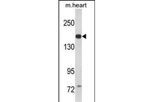 Western blot analysis of CORIN Antibody (Center) (ABIN390854 and ABIN2841076) in mouse heart tissue lysates (35 μg/lane). (Corin antibody  (AA 459-490))