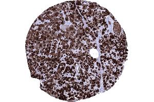 Normal pancreas with strong CELA3B positivity of acinar cells (Recombinant Elastase 3B antibody  (AA 82-238))