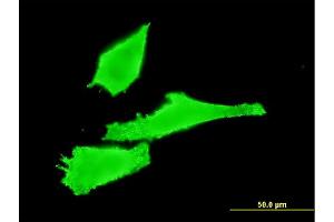 Immunofluorescence of monoclonal antibody to RAB42 on HeLa cell. (RAB42 antibody  (AA 46-105))