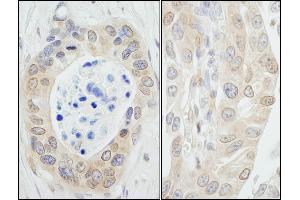 anti-N-Myc (And STAT) Interactor (NMI) (C-Term) antibody