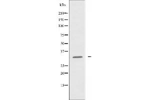 Western blot analysis of extracts from Jurkat cells, using ATF5 antibody. (ATF5 antibody  (N-Term))