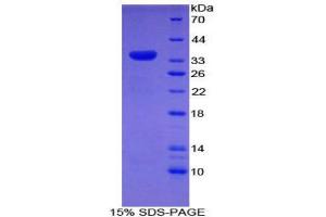 SDS-PAGE (SDS) image for Myosin ID (MYO1D) (AA 512-788) protein (His tag) (ABIN1878521) (Myosin ID Protein (MYO1D) (AA 512-788) (His tag))