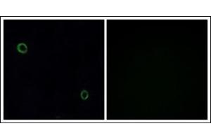 Immunofluorescence analysis of A549 cells, using CXCR4 Antibody. (CXCR4 antibody  (C-Term))