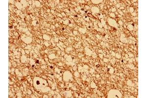 Immunohistochemistry analysis of human brain tissue using ABIN7147533 at dilution of 1:100 (CHMP6 antibody  (AA 2-201))