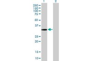 Western Blotting (WB) image for anti-G Protein-Coupled Receptor, Family C, Group 5, Member D (GPRC5D) (AA 1-345) antibody (ABIN527551)