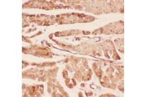 IHC-P testing of rat heart tissue (Desmin antibody  (AA 1-304))