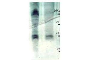 Affinity Purified anti-phosphothreonine (pT) antibody is shown to detect phosphorylated proteins present in mouse spleen cell lysates.