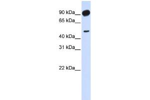 WB Suggested Anti-ADD2 Antibody Titration: 0. (ADD2 antibody  (Middle Region))