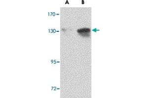 Western blot analysis of NUP155 in P815 cell lysate with NUP155 polyclonal antibody  at (A) 0. (NUP155 antibody  (C-Term))