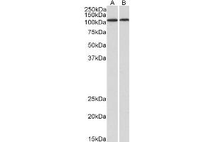 Western Blotting (WB) image for anti-Bone Morphogenetic Protein 1 (BMP1) (AA 284-296) antibody (ABIN5858701) (BMP1 antibody  (AA 284-296))