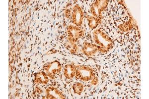 Immunohistochemistry (IHC) image for anti-Jun Proto-Oncogene (JUN) (pThr91) antibody (ABIN6256604)