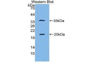 Detection of Recombinant SPINK5, Human using Polyclonal Antibody to Serine Peptidase Inhibitor Kazal Type 5 (SPINK5) (SPINK5 antibody  (AA 699-976))